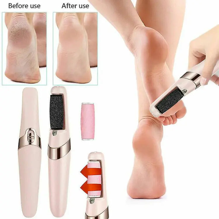 Electric Foot Callus Remover: Electric Pedicure Device