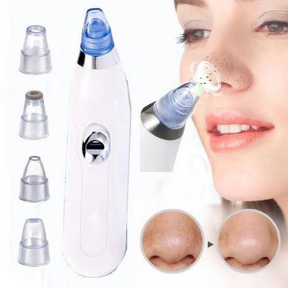 Blackhead Extractor Device: DermaSuction™ with Cell Operation for Blackhead Removal